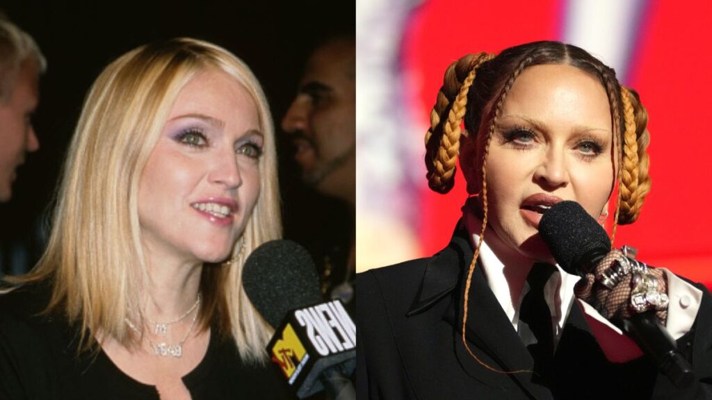 Imagen comparativa de Madonna antes y después de someterse a tratamientos de Pillow Face